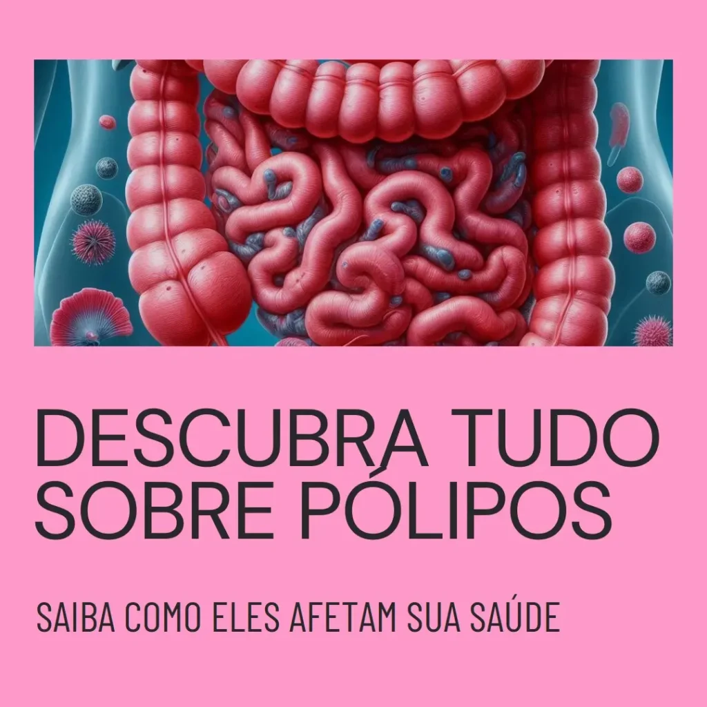 Pólipo: O Que É e Como Afeta Sua Saúde?