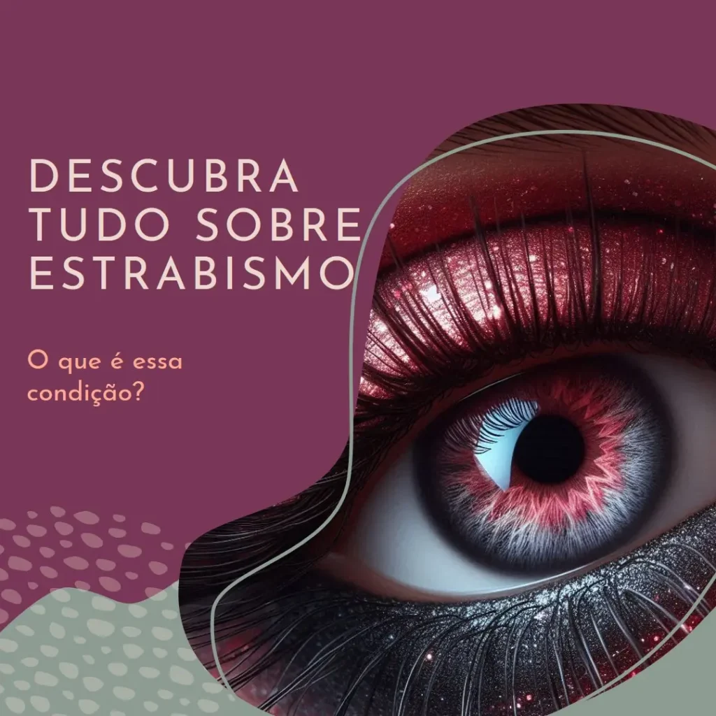 Estrabismo o que é? Descubra Tudo Sobre Essa Condição