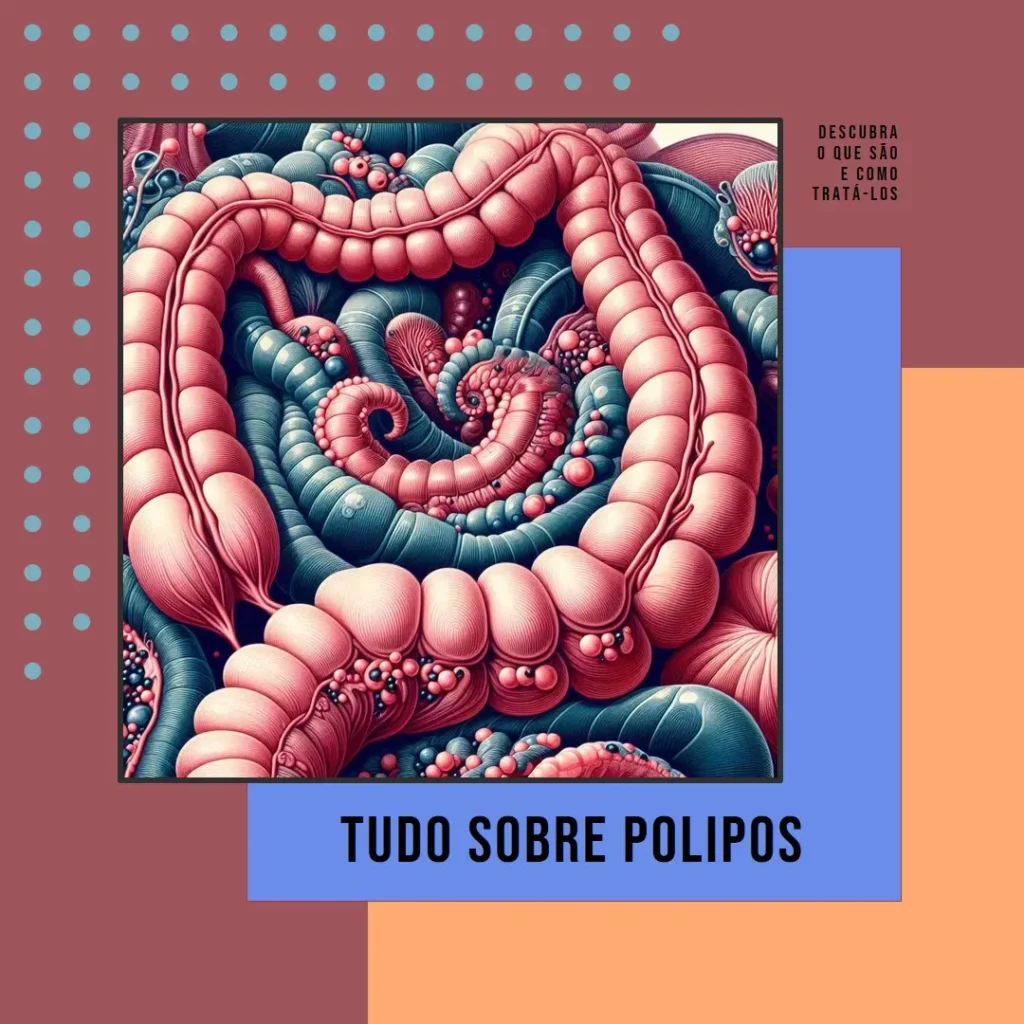 O que é Polipos: Tudo o que Você Precisa Saber