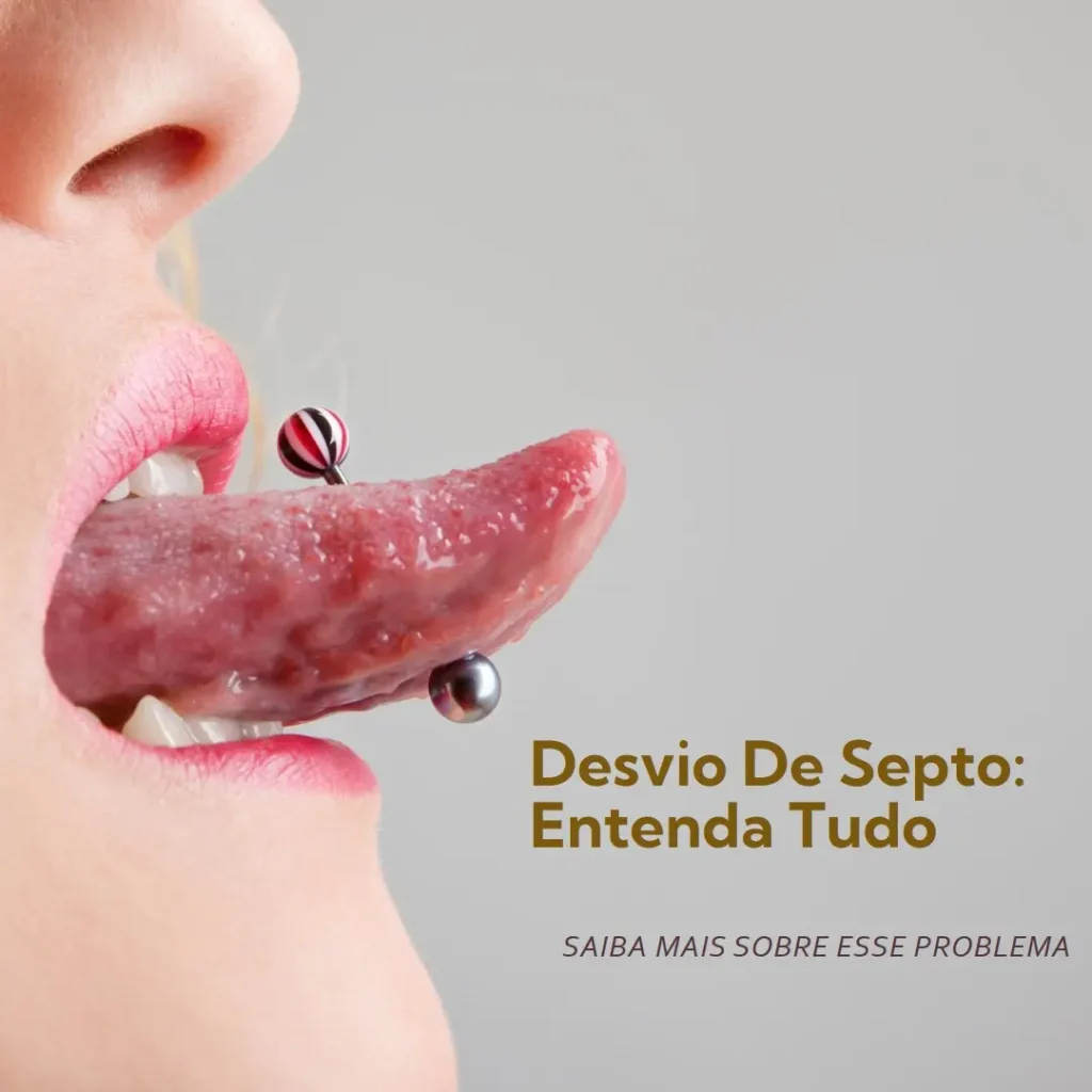 O que é Desvio de Septo: Entenda Tudo Sobre Esse Problema